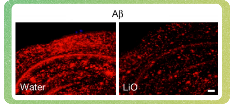 Reducción de la acumulación de la β-amiloide en ratones con Alzheimer tratados con litio