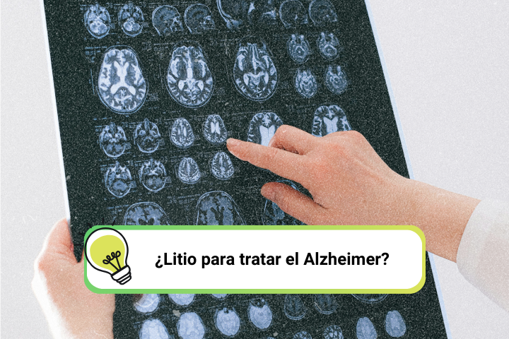 Imagen-de-Portada-Litio-Alzheimer-BioLynx