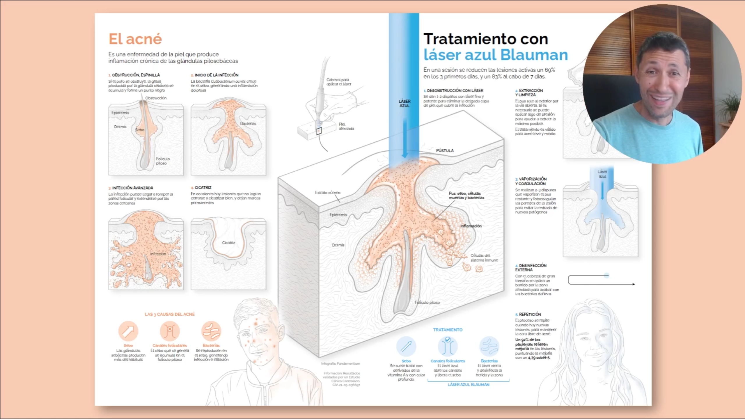 Ilustración